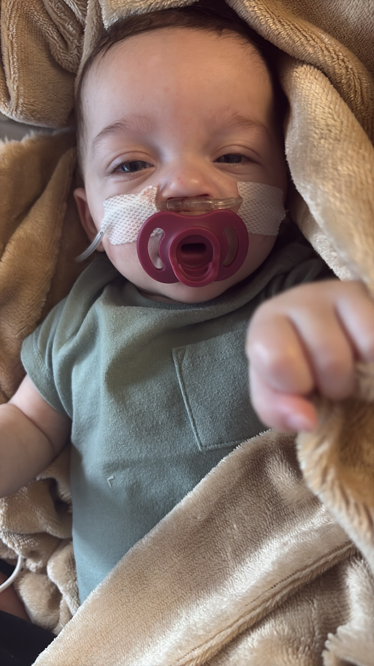 Help baby Liam fight lifelong medical issues! — photo 2