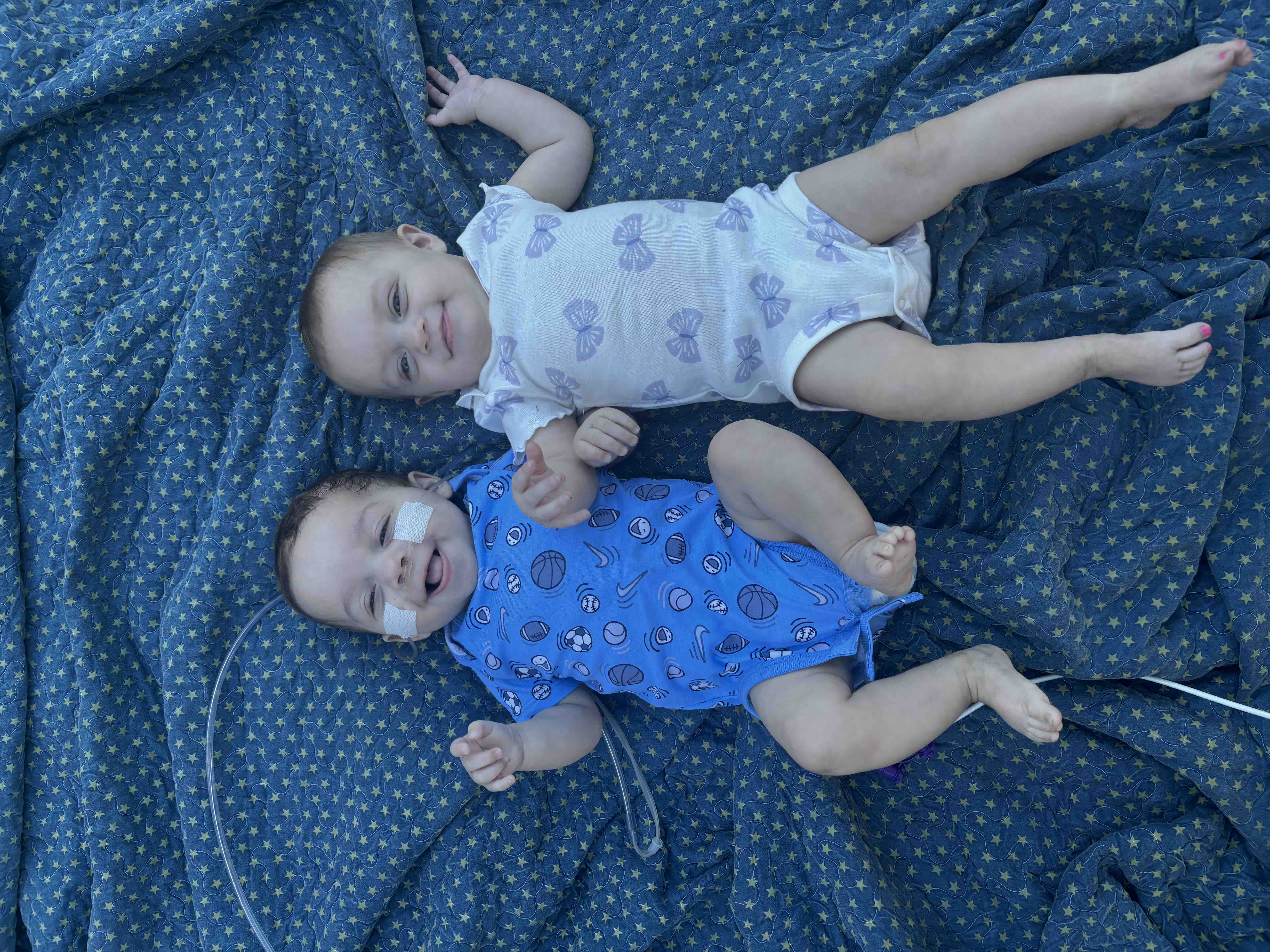 Help baby Liam fight lifelong medical issues! — photo 4