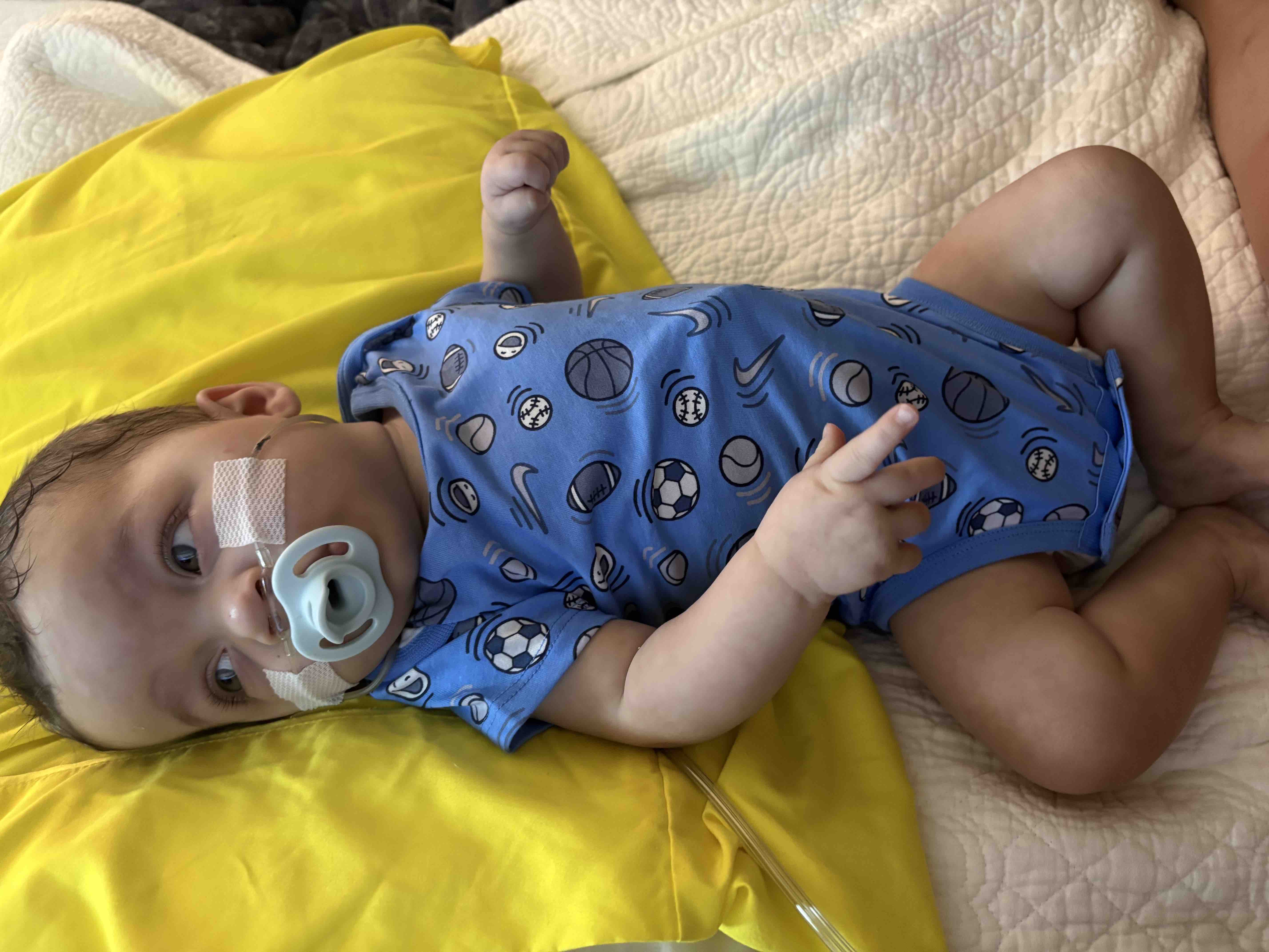 Help baby Liam fight lifelong medical issues! — photo 5