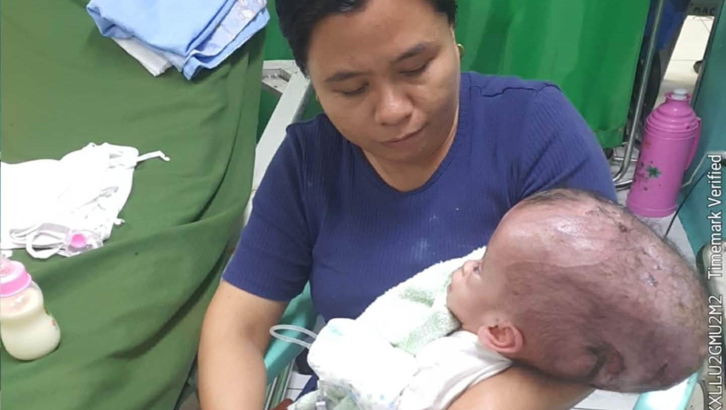 Help baby Sofia fight hydrocephalus