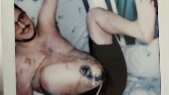 Prosthesis and medical expenses for Rodrigo