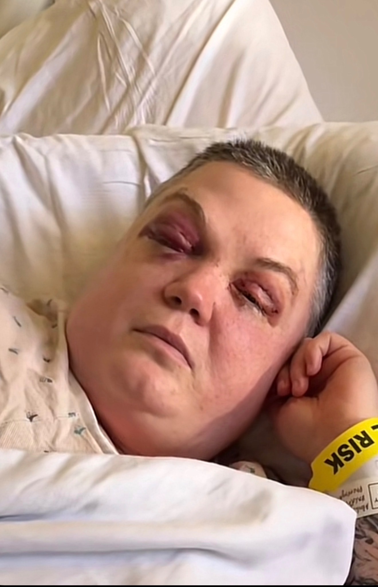 Help Erica With Her Battle Against Cancer and Brain Disease β photo 2