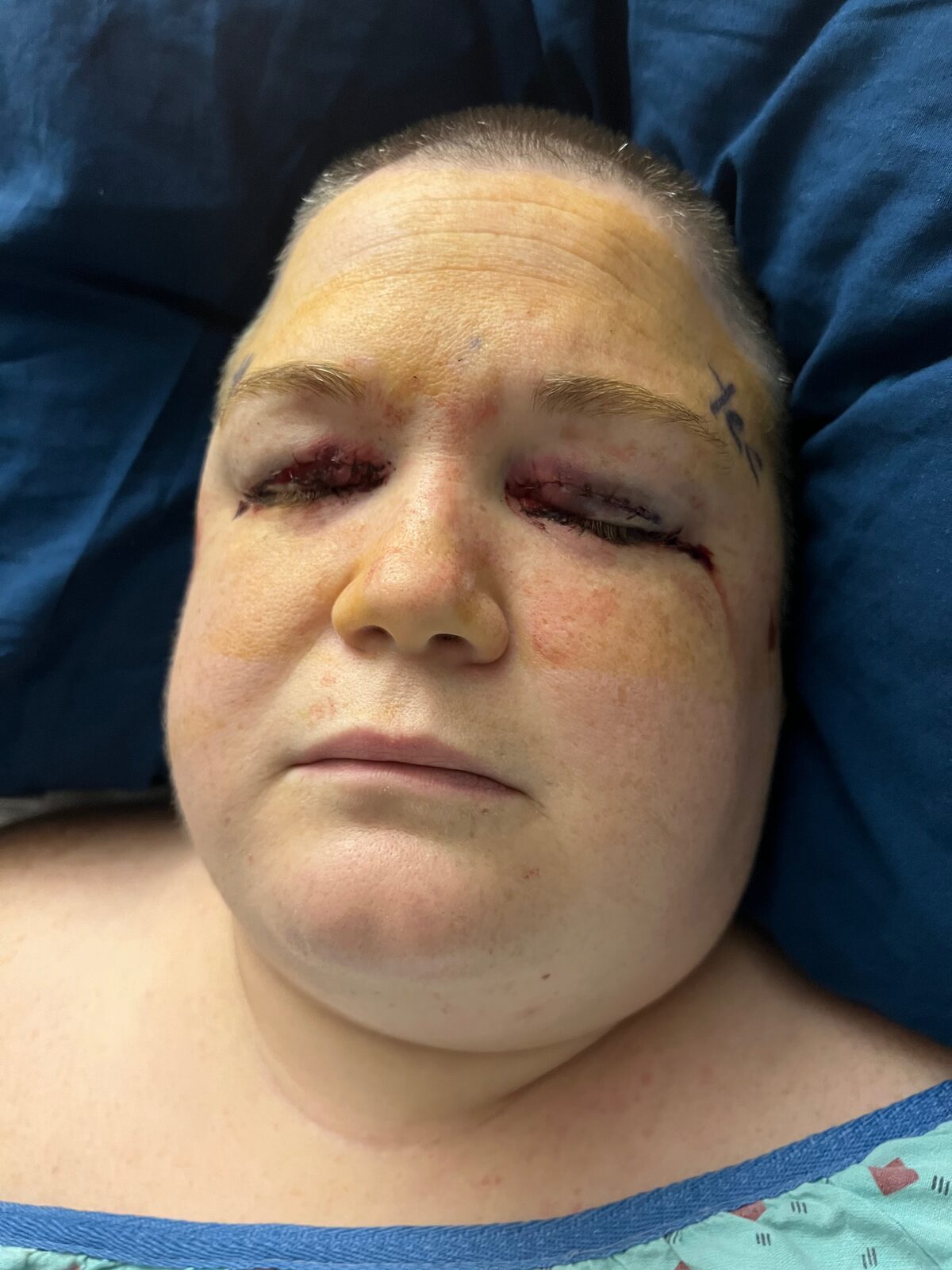 Help Erica With Her Battle Against Cancer and Brain Disease β photo 5