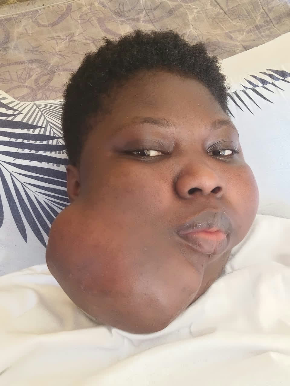 Help Joyce access urgent surgery for a severe jaw tumour β photo 2