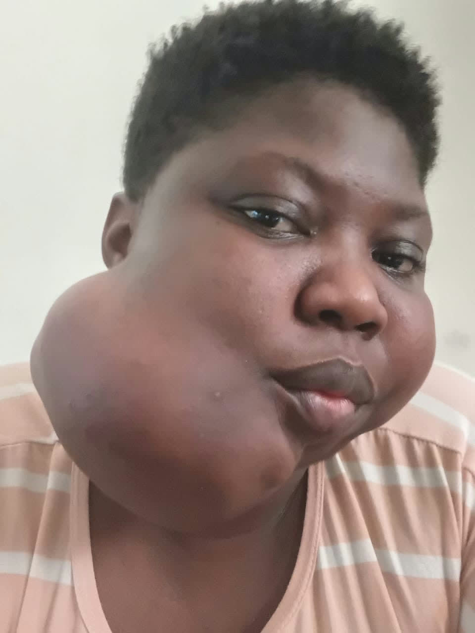 Help Joyce access urgent surgery for a severe jaw tumour β photo 4