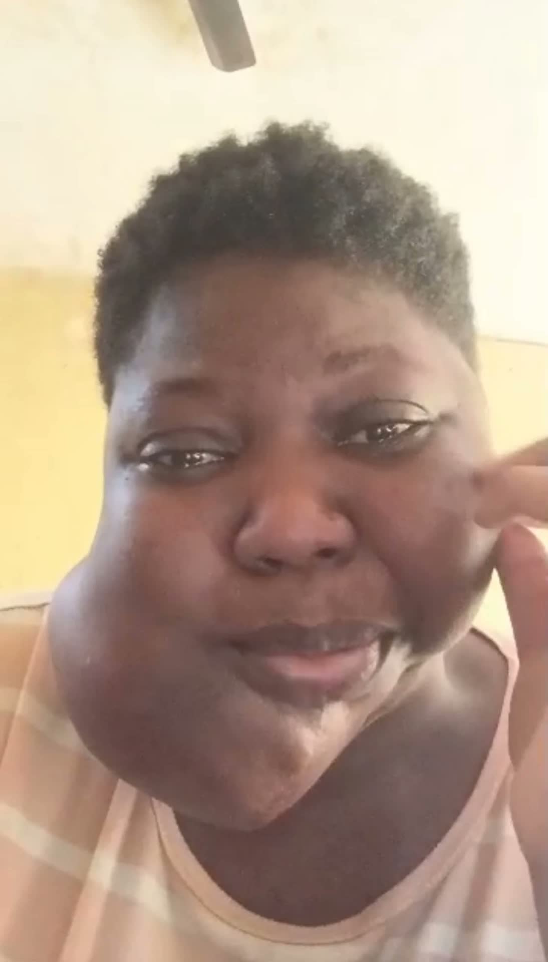 Help Joyce access urgent surgery for a severe jaw tumour β photo 5