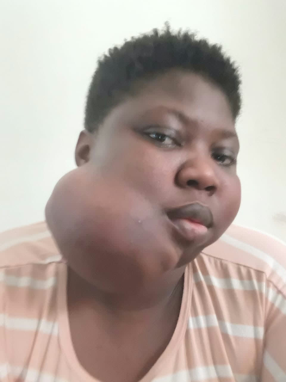 Help Joyce access urgent surgery for a severe jaw tumour β photo 6